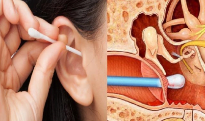 Kesalahan Saat Membersihkan Telinga yang Mulai Harus Dihentikan