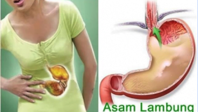 Tanda Kamu Kena Penyakit Asam Lambung