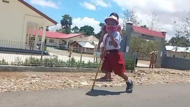 Kisah Yesi Menyentuh Hati Prabowo Siap Bantu Sediakan Kaki Palsu