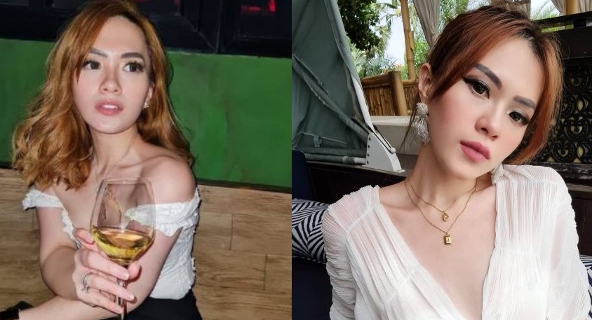 Tak Dijebloskank ke Bui, Selebgram Jessica Foresster Jalani Rehabilitasi