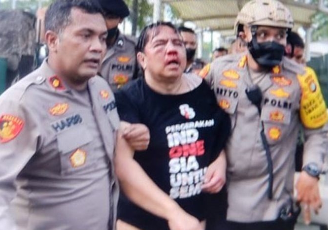 Kuasa Hukum Gelar Sayembara Tangkap Pelaku Pelucutan Pakaian Ade Armando