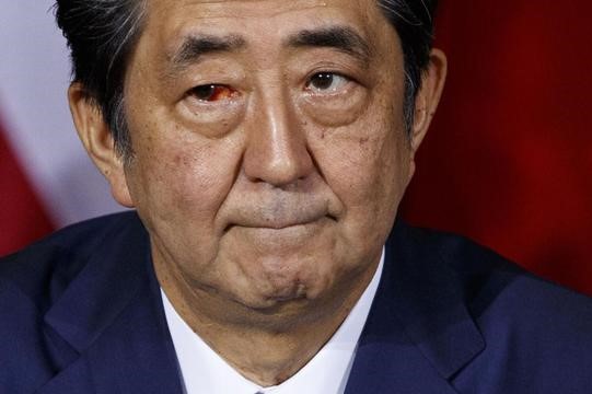 Shinzo Abe Meninggal Dunia Usai Ditembak dari Jarak 3 Meter